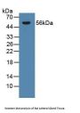Steroid 21-Hydroxylase (CYP21A2) Antibody