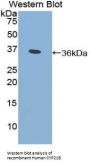 Steroid 21-Hydroxylase (CYP21A2) Antibody