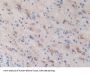 Steroid 21-Hydroxylase (CYP21A2) Antibody