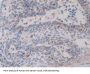 Steroid 21-Hydroxylase (CYP21A2) Antibody