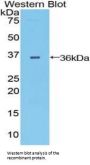 Dispatched Homolog 1 (DISP1) Antibody