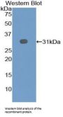 Early B-Cell Factor 2 Antibody