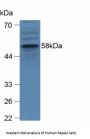 Glucosidase Beta, Acid (GbA) Antibody