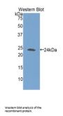 Glutathione Synthetase (GSS) Antibody