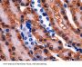 Glutathione Synthetase (GSS) Antibody