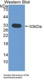Hyaluronan Synthase 1 (HAS1) Antibody