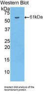 Hydroxyacid Oxidase 1 (HAO1) Antibody