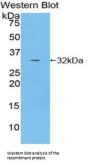 Hydroxyacid Oxidase 1 (HAO1) Antibody