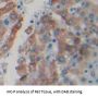 Hydroxyacid Oxidase 1 (HAO1) Antibody