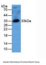 Mannose Binding Lectin (MBL) Antibody
