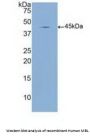 Mannose Binding Lectin (MBL) Antibody
