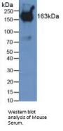 Pregnancy Zone Protein (PZP) Antibody