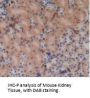 Pregnancy Zone Protein (PZP) Antibody