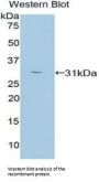 Protein Kinase C zeta (PKCZ) Antibody