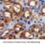 Protein Kinase C zeta (PKCZ) Antibody