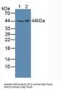 Sphingosine Kinase 1 (SPHK1) Antibody