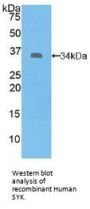 Spleen Tyrosine Kinase (SYK) Antibody