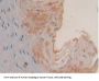 Spleen Tyrosine Kinase (SYK) Antibody