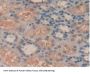 Spleen Tyrosine Kinase (SYK) Antibody