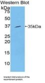 Spleen Tyrosine Kinase (SYK) Antibody
