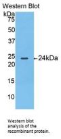 Thymidine Phosphorylase (TP) Antibody