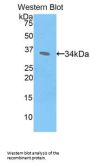CREB Binding Protein (CREBBP) Antibody
