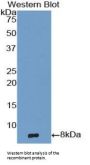 Epidermal Growth Factor (EGF) Antibody