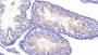 Histone Deacetylase 6 (HDAC6) Antibody