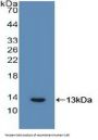 Interleukin 6 Receptor (IL6R) Antibody