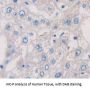 Interleukin 6 Receptor (IL6R) Antibody