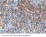 Interleukin 7 Receptor (IL7R) Antibody