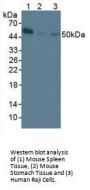 Nuclear Factor kappa B Antibody