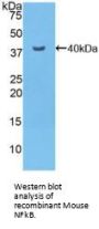 Nuclear Factor kappa B Antibody