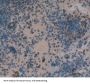 Nuclear Factor kappa B Antibody
