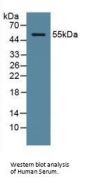 Ornithine Decarboxylase Antibody
