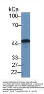 Tachykinin Receptor 2 (TACR2) Antibody