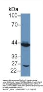 Tachykinin Receptor 2 (TACR2) Antibody
