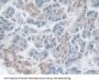 Tachykinin Receptor 2 (TACR2) Antibody