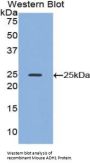 Alcohol Dehydrogenase 1 (ADH1) Antibody