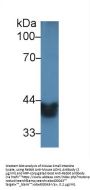 Alcohol Dehydrogenase 1 (ADH1) Antibody