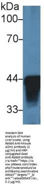 Alcohol Dehydrogenase 1 (ADH1) Antibody