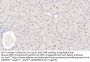 Alcohol Dehydrogenase 1 (ADH1) Antibody