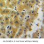 beta Lipotropic Hormone Antibody