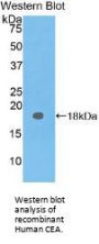 Carcinoembryonic Antigen-Related Cell Adhesion Molecule 5 (CEACAM5) Antibody