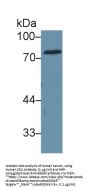 Carcinoembryonic Antigen-Related Cell Adhesion Molecule 5 (CEACAM5) Antibody
