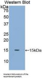 Carcinoembryonic Antigen-Related Cell Adhesion Molecule 5 (CEACAM5) Antibody