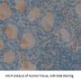 Carcinoembryonic Antigen-Related Cell Adhesion Molecule 5 (CEACAM5) Antibody