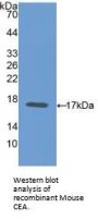 Carcinoembryonic Antigen Antibody