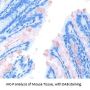 Carcinoembryonic Antigen Antibody