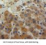 Enolase, Muscle Specific (MSE) Antibody